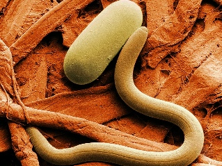 Признаци за наличието на паразити в човешкото тяло