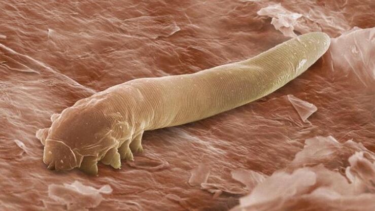 червей, който живее под човешката кожа