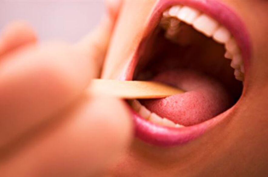 Видове паразити в човешката уста